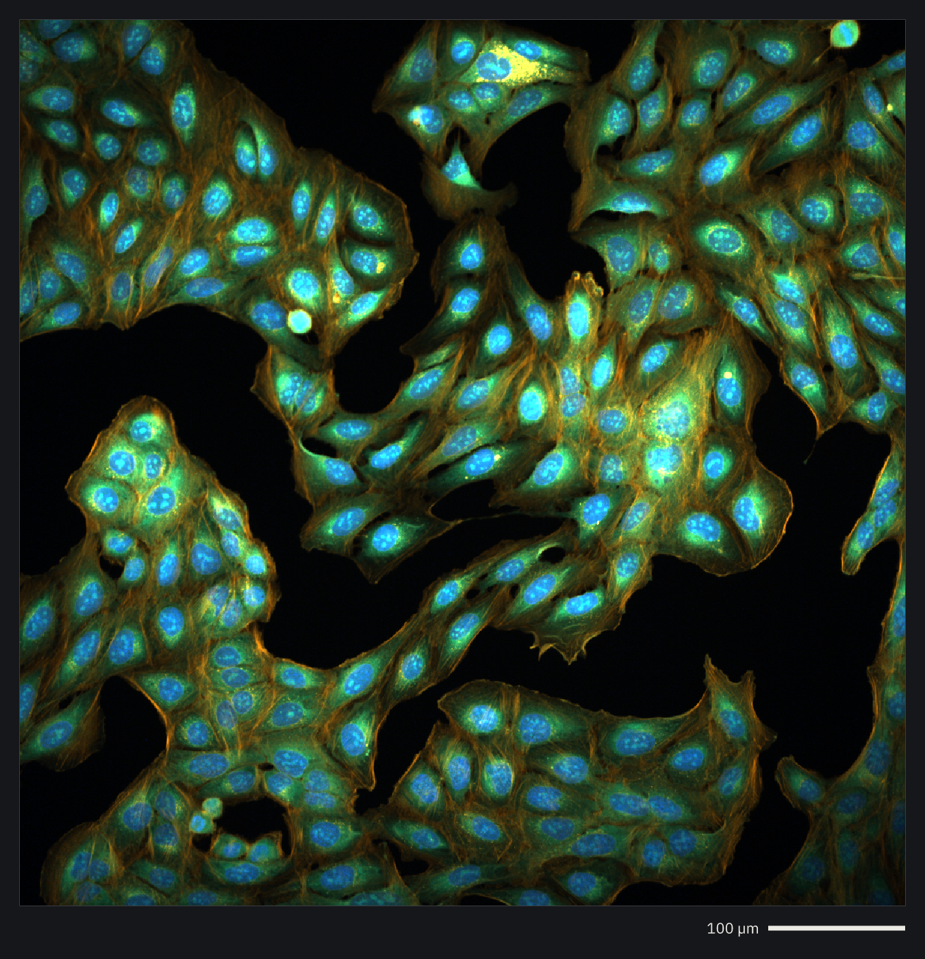 A Cell Painting field