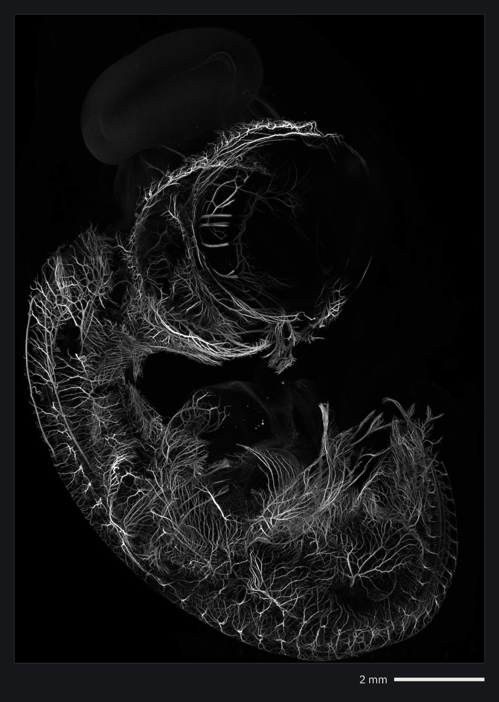 A chicken embryo by light sheet