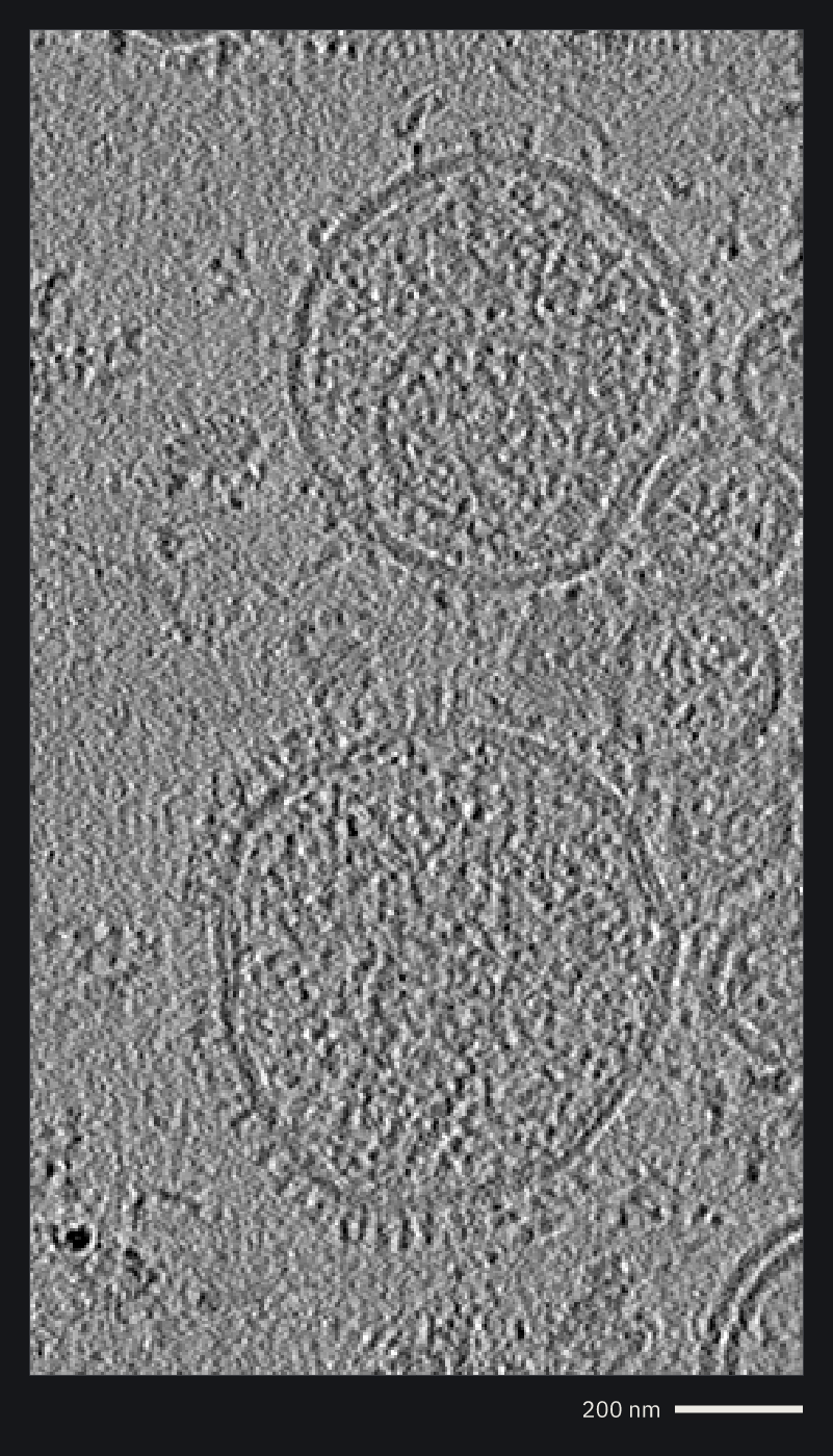 Virions in a cryo-electron tomogram