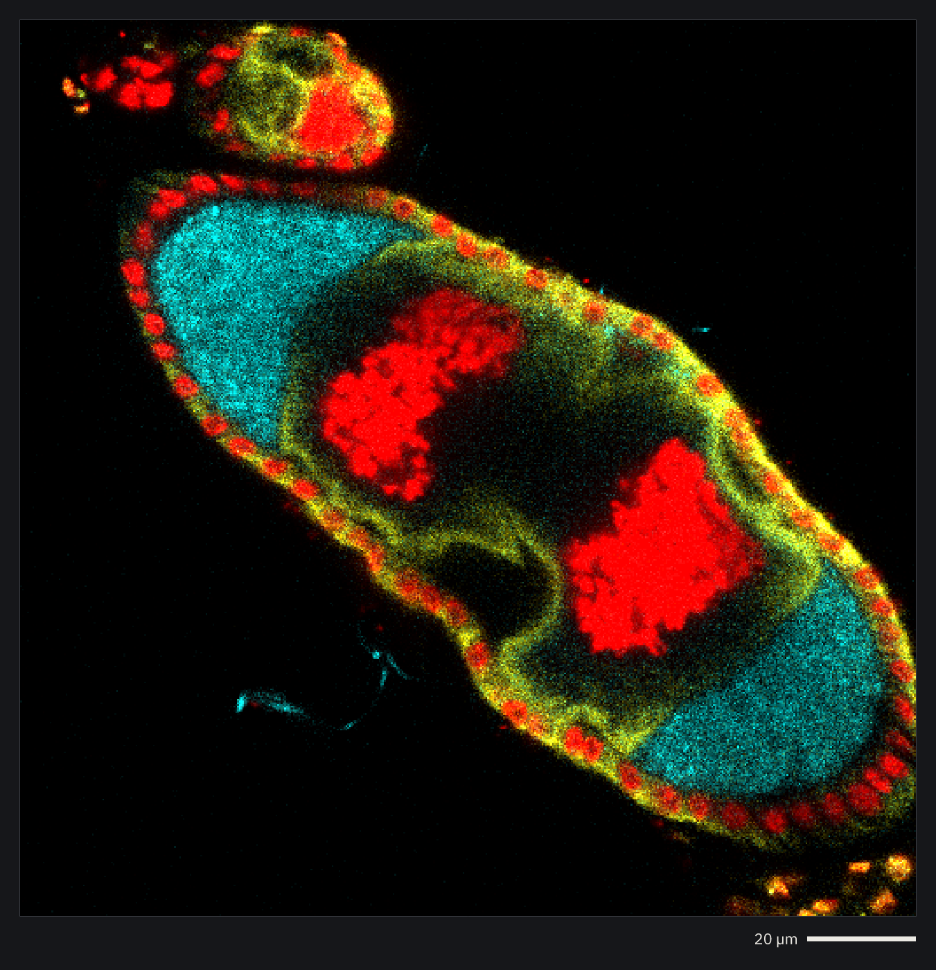 A fruit fly egg chamber
