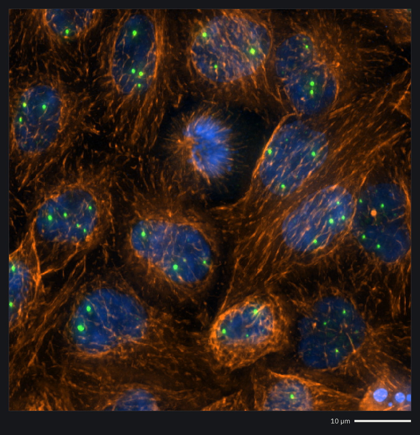 HeLa cells and their Cajal bodies