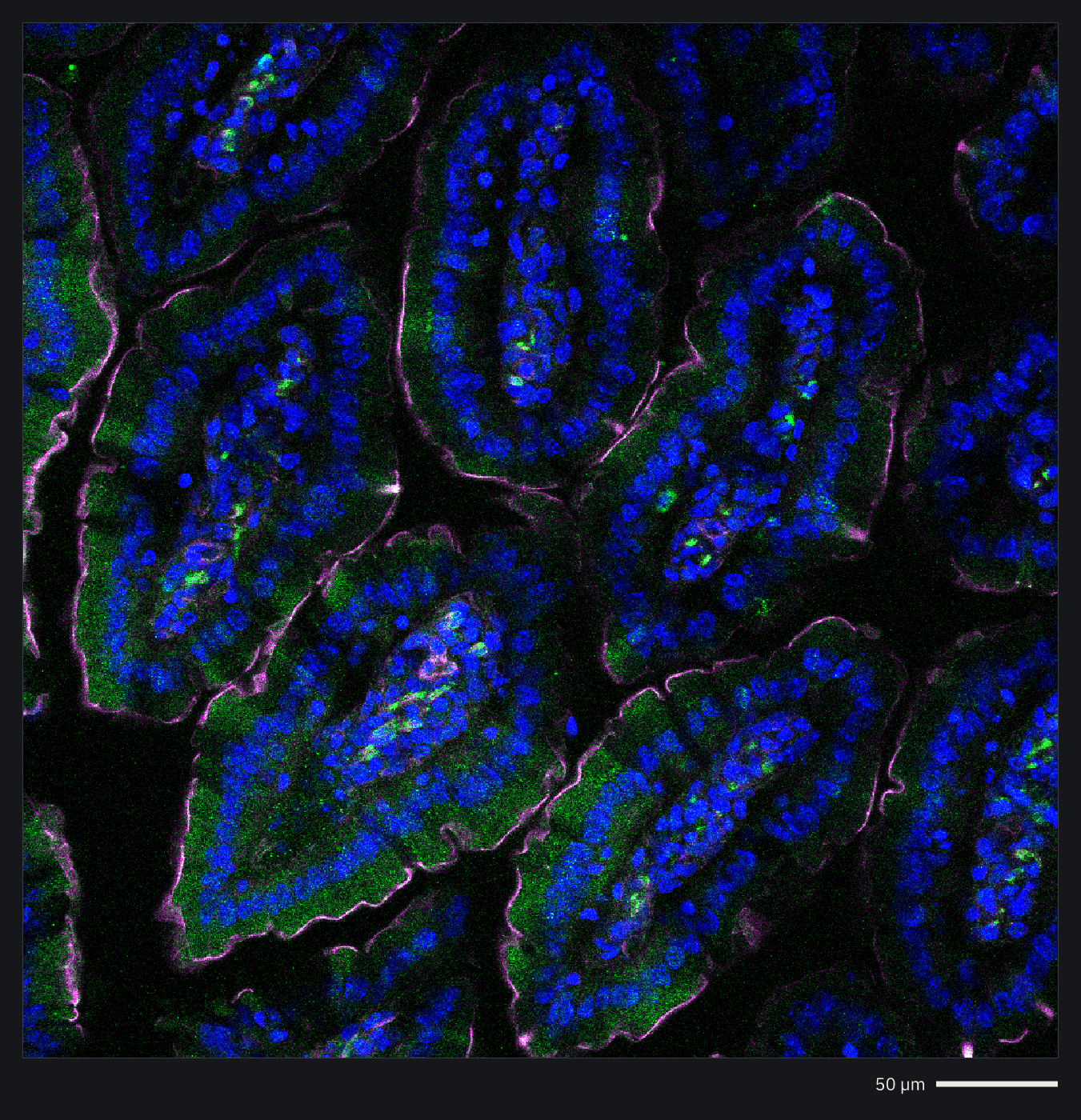 Intestinal villi