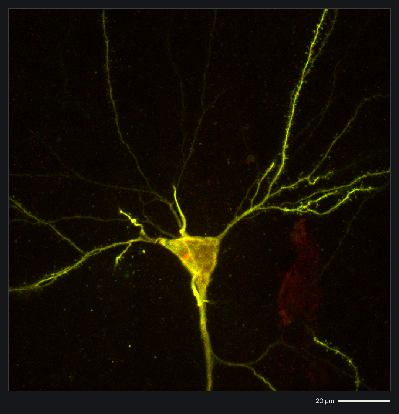 One neuron and its dendrites