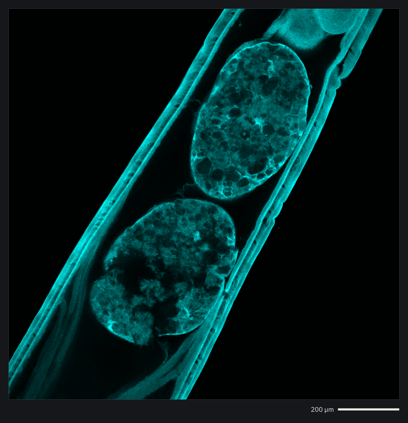 A confocal image of testes