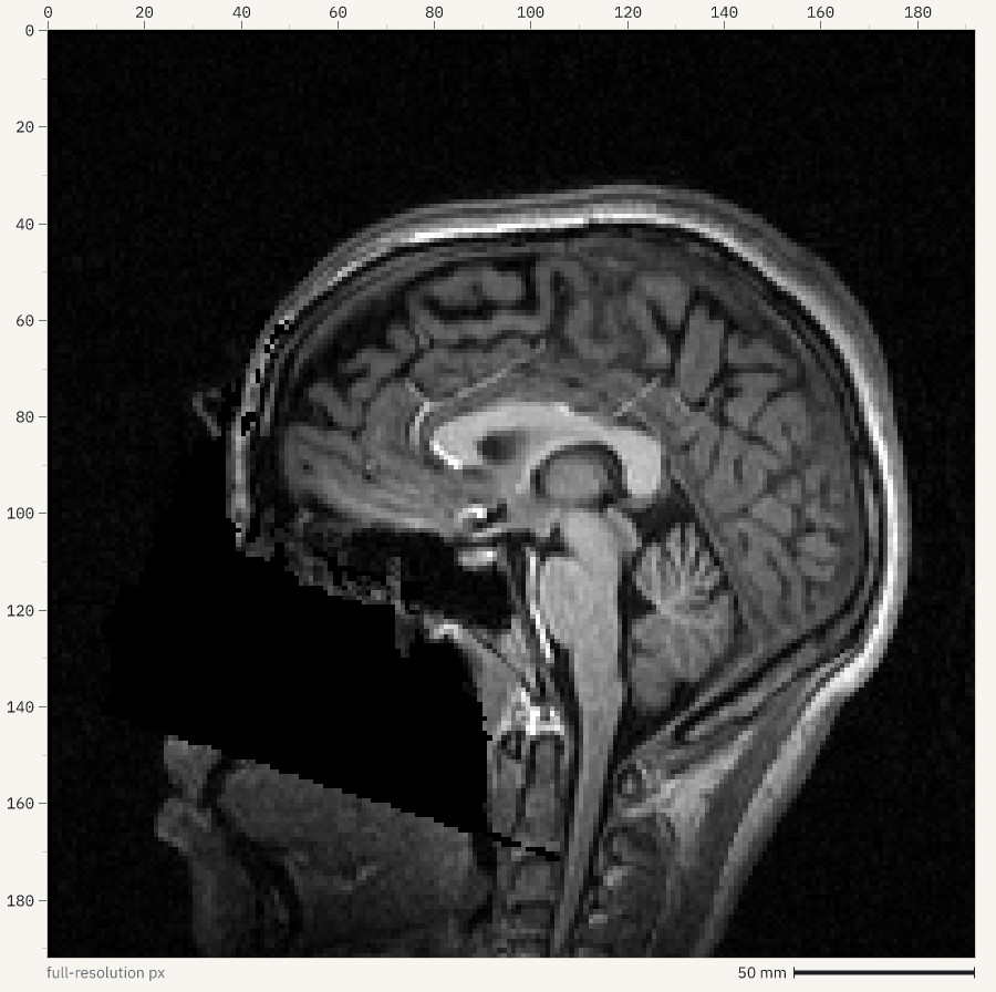 Sagittal slice of a T1-weighted brain MRI with pixel rulers and a 50 mm scale bar